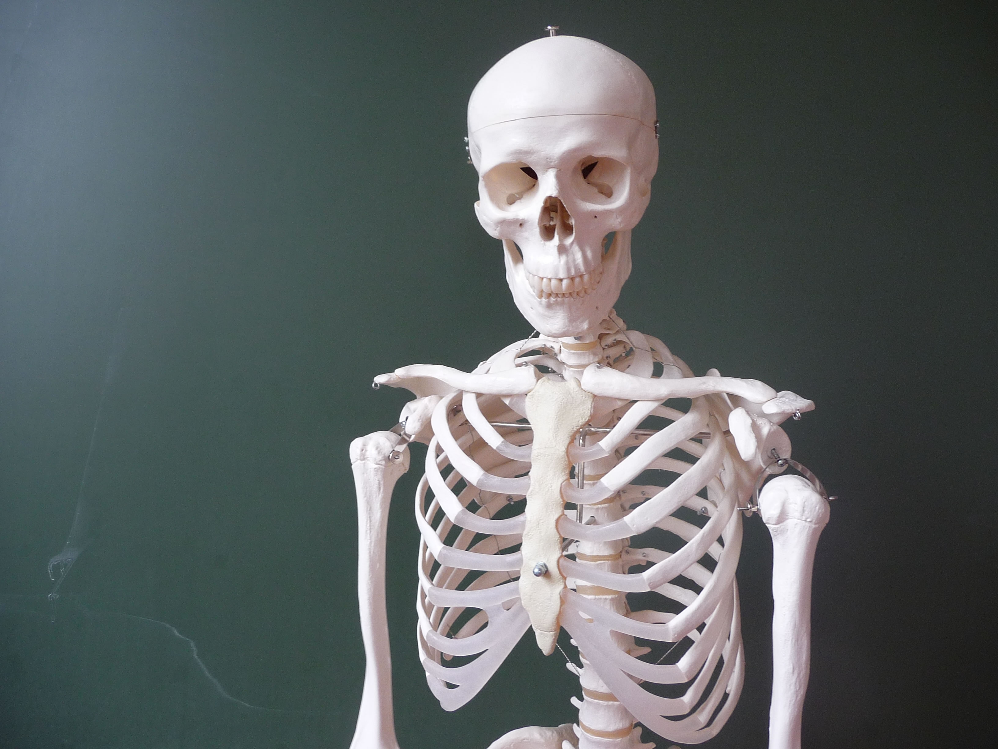 В Челябинске нашли скелет пропавшего человека