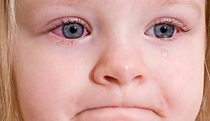 Заболевания глаз у детей